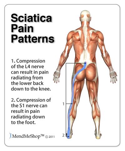 Lower Back Pain Stretches: Lower Back Pain Stretches Hip Bursitis