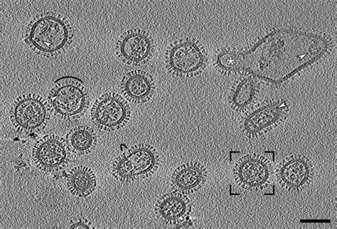 Virus Under Electron Microscope