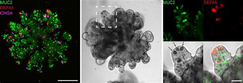 Optimization of human small intestinal organoids - Hubrecht Institute