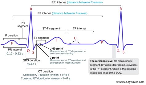 Normal 12 Lead Ecg Labeled