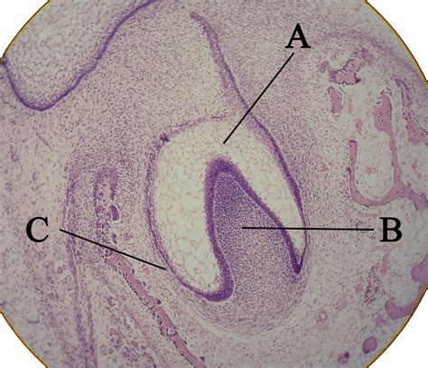 Tooth development - wikidoc