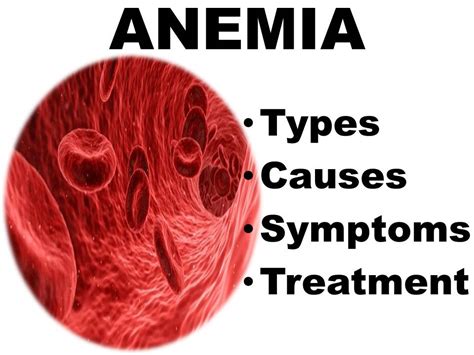 Anemia: Types, Causes, Symptoms, & Treatment - My Health By Web