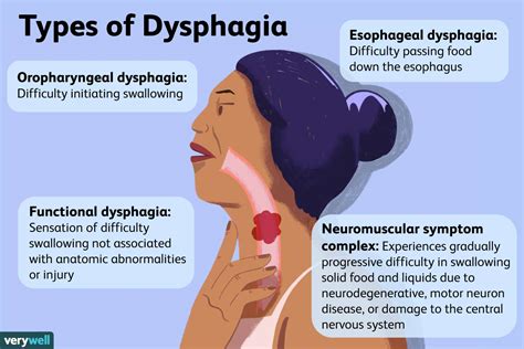 Cause of Functional Dysphagia: Anxiety, Depression, and More