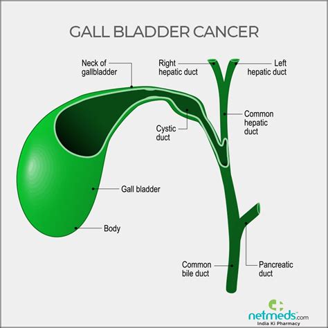 Gall Bladder Cancer - Causes, Symptoms and Treatment