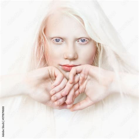 Albino girl with white skin, natural lips and white hair. Photo face on a light background ...