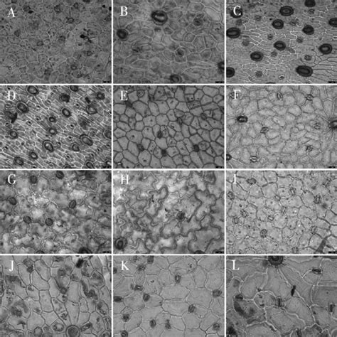 Scanning electron microscope photographs of epidermal cells in... | Download Scientific Diagram