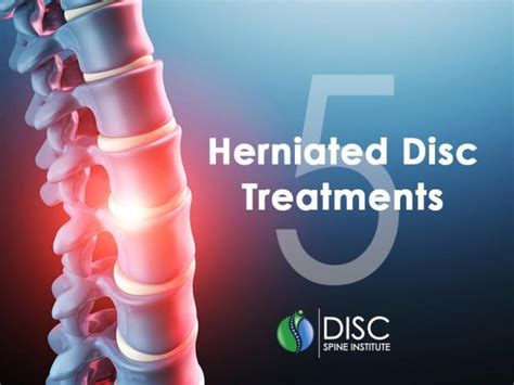 5 Herniated Disc Treatments | DISC Spine Institute TX