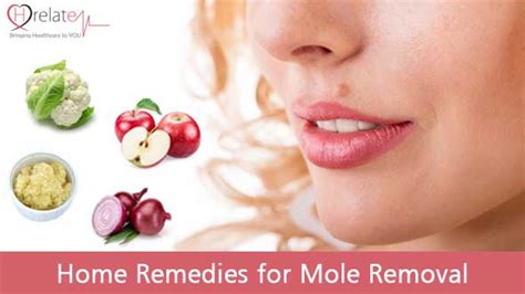 Home Remedies for Mole Removal - Chehre Se Masse Hataye