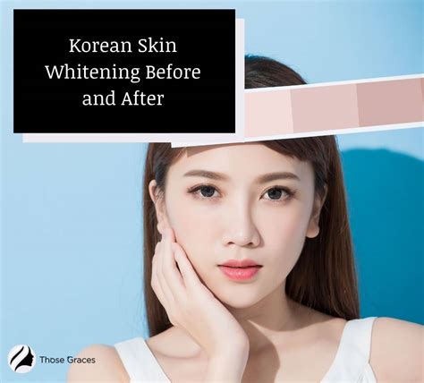 Korean Skin Whitening Before and After (With Videos) - ThoseGraces.com