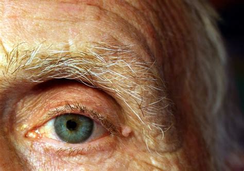 Some Of The Common Eye Diseases In Elderly People - Goggles4u.com