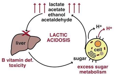 Lactic Acidosis - Causes, Symptoms, Lactic Acidosis Treatment