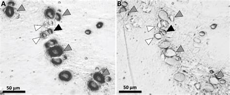 Figure 3 from Evaluation of Cyanea capillata Sting Management Protocols Using Ex Vivo and In ...