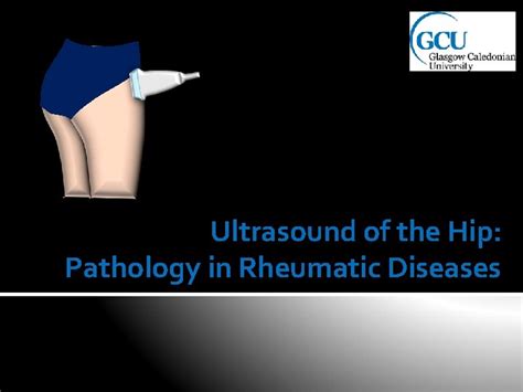 Ultrasound of the Hip Pathology in Rheumatic Diseases