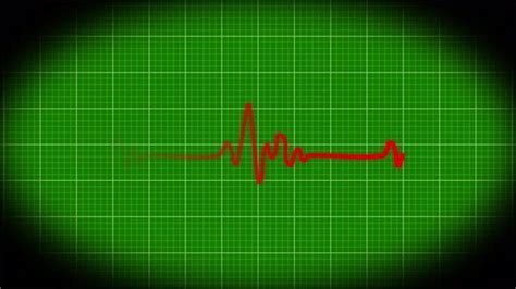 Health ECG Heart Beat Line Simulation animation. Vd 1965, Motion Graphics