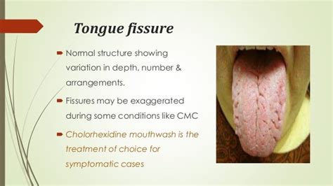 Diseases of lips & tongue