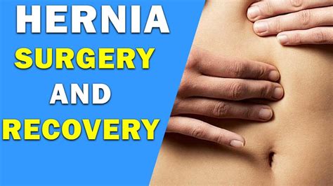 Pin by Shanon Willis on Health | Abdominal hernia, Hernia symptoms, Surgery