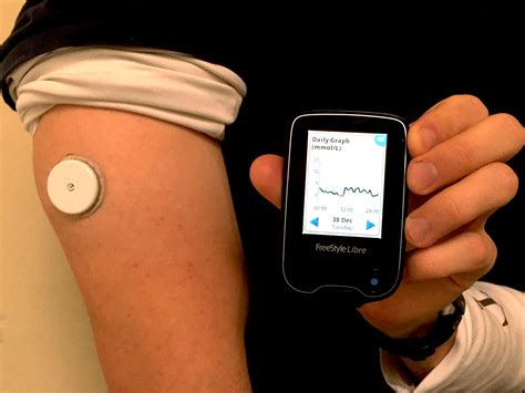 Abbott’s FreeStyle Libre – Transforming Glucose Monitoring Through Utter Simplicity ...