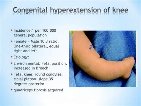 Orthopedic problems in neonates