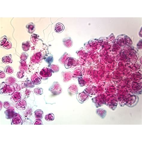 Ciliates Microscope Slides (b coli, paramecium, stentor, vorticella) | Carolina.com