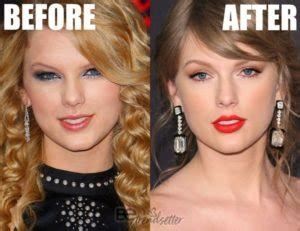 taylor-swift-nose-job-2007-2019 | Be Trendsetter