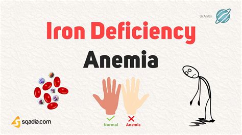 Iron Deficiency Anemia - Introduction