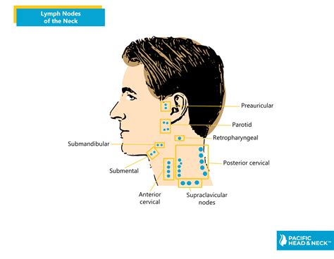 Swollen Lymph Nodes Neck One Side