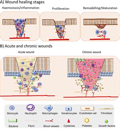 A) Wound healing stages: haemostasis and inflammation, proliferation... | Download Scientific ...