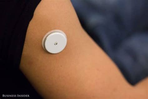 This Wearable Monitors Your Blood Glucose Levels In Real-Tim