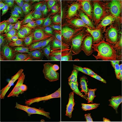 Art of the Science: Cell Painting | Charles River