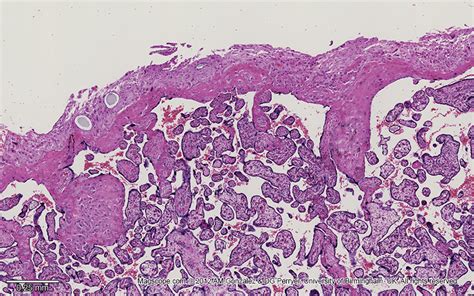 Placenta Histology Decidua