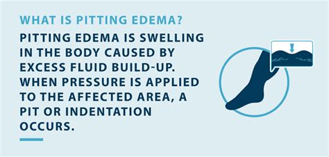 Pitting Edema Vs Edema