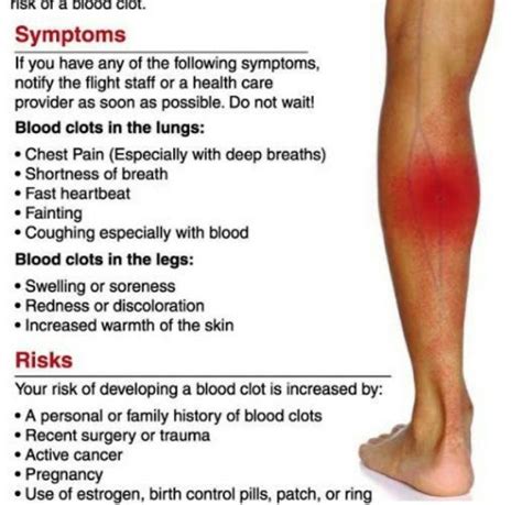 Blood Clot In Leg Symptoms « MedicineBTG.com