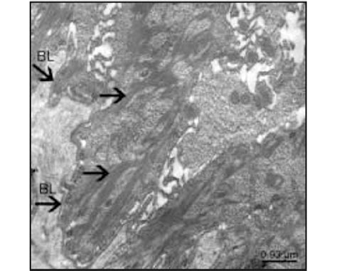 Electron microscopic image showing continuous basal lamina (BL) and... | Download Scientific Diagram