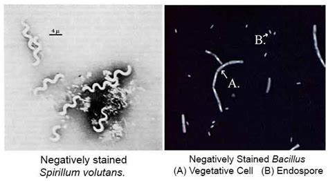 Negative Staining- Principle, Reagents, Procedure and Result