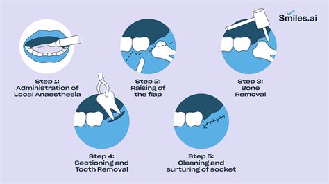 Everything you need to know about the Wisdom tooth extraction