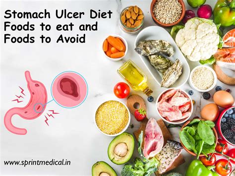 Stomach Ulcer Diet: Foods to eat and Foods to Avoid | Sprint Medical