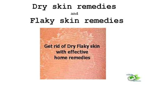 Dry skin remedies and Flaky skin remedies - Noble Home Remedies