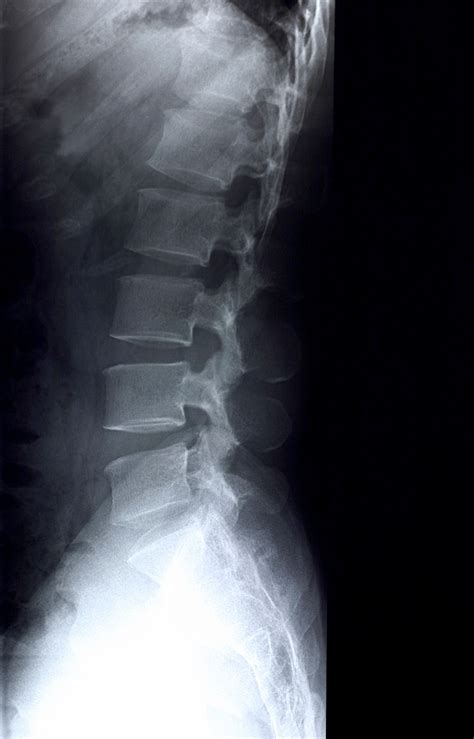 Sangrar Haz lo mejor que pueda Incorrecto radiografia de todo el cuerpo Dar derechos Prefacio ...