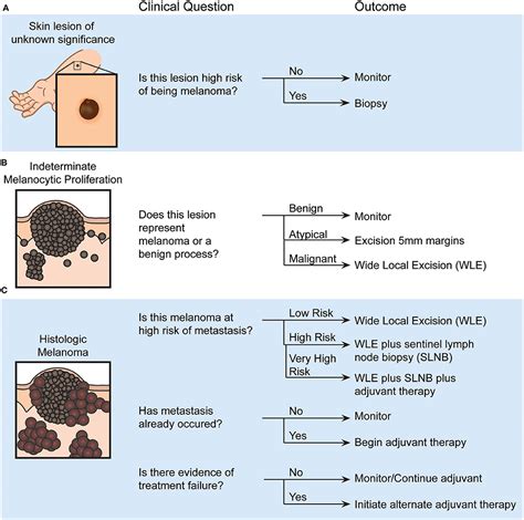 How To Diagnose Melanoma - Methodchief7