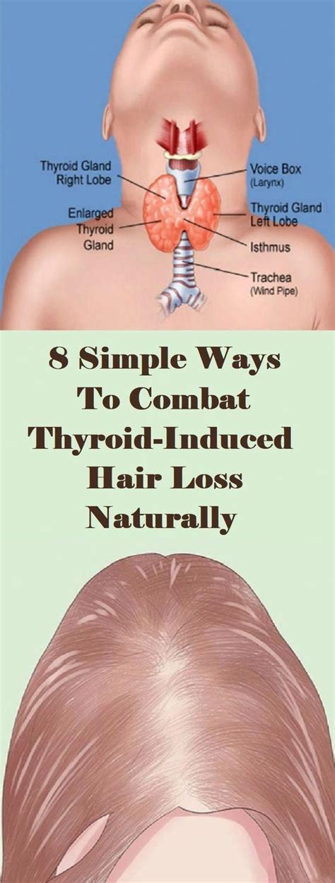 Can A Thyroid Problem Cause Hair Loss?