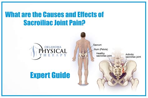 Pelvic Bone Pain Causes