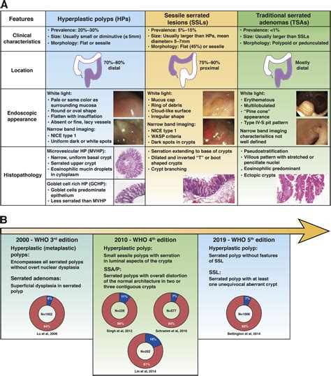 Review Article: What are Serrated Colorectal Polyps? – AGA Journals Blog