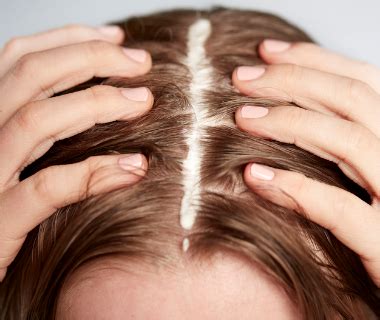 The 5 Main Reasons You May Be Suffering From A Dry Scalp - Ameliorate