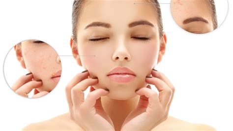 Pigmentation affects people of all ages and races, but understanding the causes can help prevent ...