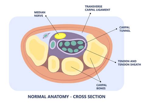 carpal-tunnel-syndrome-cross-section-diagram-propel-physiotherapy ...