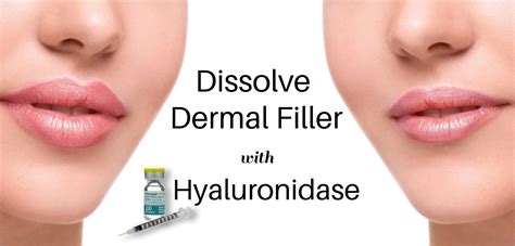 Hyaluronidase | Dermal Filler Removal | Dissolve Dermal Filler