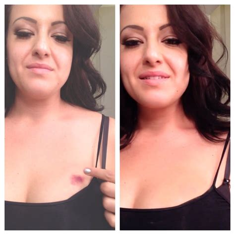 How to Cover a Hickey with Makeup - PattiKnows | Patti Stanger