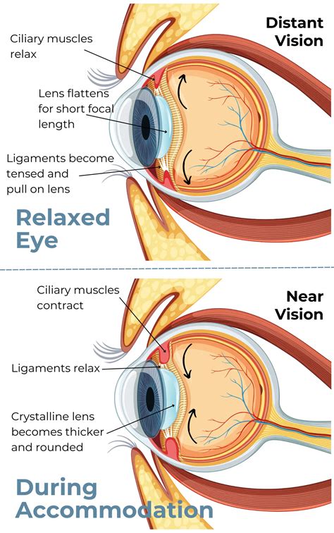 Accommodation of Eye- Definition and Process | AccuVision