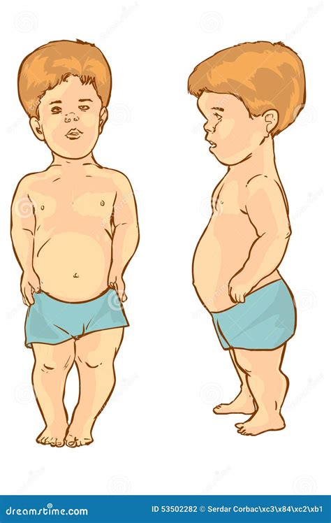 Dwarfism Stock Illustrations – 74 Dwarfism Stock Illustrations, Vectors ...