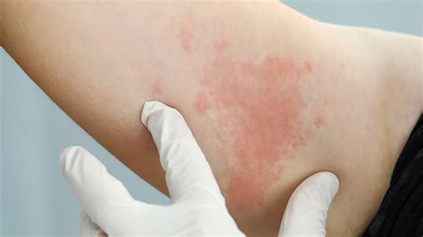 The Common Skin Diseases that Require Medical Attention - Impulse Today